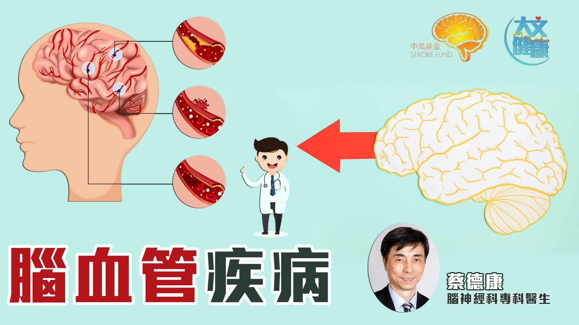 香港中風基金｜腦血管疾病｜蔡德康 腦神經科專科醫生